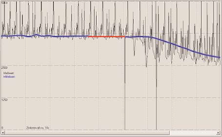 Filterung der mehrstufigen Messwertaufbereitung
(blaue Linie) und Auswertung der Endfilterung (rote
Linie)